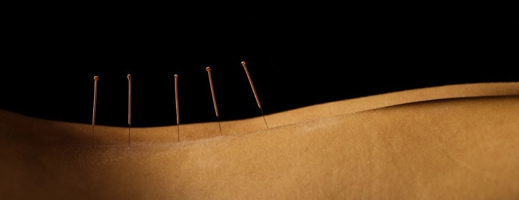 Acupuncture Louise Robinson | 988 Chemin de la Rivière aux Outardes, Ormstown, QC J0S 1K0, Canada | Phone: (450) 829-2775