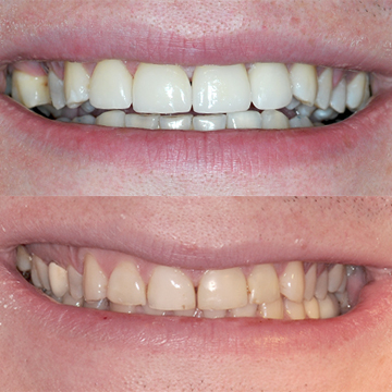 Lakeshore Dental. Cosmetic and Implant Dentistry Center. Dr Izab | 16 Brookers Ln Unit 10A, Etobicoke, ON M8V 0A5, Canada | Phone: (416) 255-6400