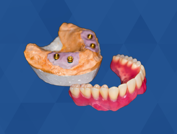 Centre de Denturologie Auprix | Denturologiste Longueuil | 780 Chem. du Coteau-Rouge, Longueuil, QC J4J 1Z3, Canada | Phone: (450) 677-9733