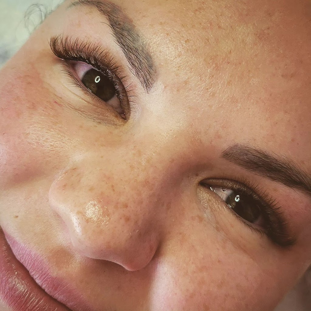 EP-DERME Esthétique - Microdermabrasion - Mont-Laurier | 2322 Chemin du Rang 4 S, Mont-Laurier, QC J9L 3G3, Canada | Phone: (819) 616-7888