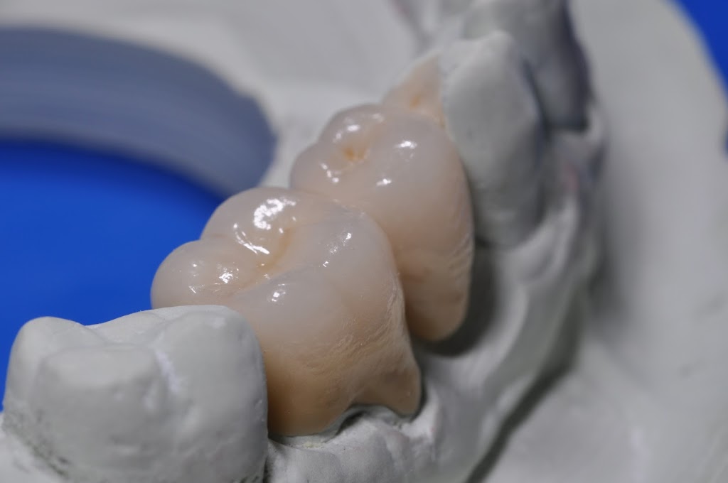 Cad Crowns Ca Inc | 210-1580 Merivale Rd, Nepean, ON K2G 4B5, Canada | Phone: (613) 723-7300