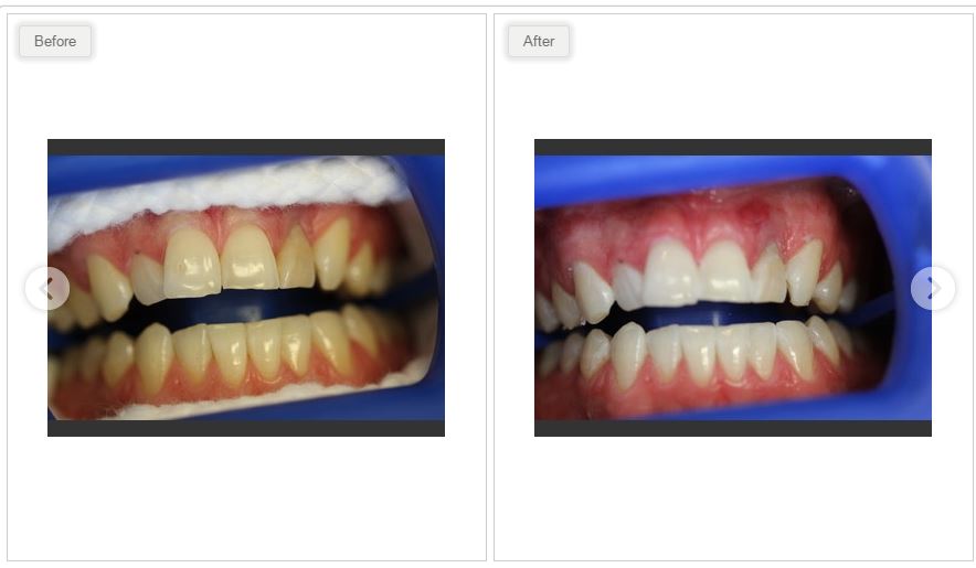 Clearview Market Dental Care | 47 Clearview Market Way #100, Red Deer, AB T4P 0M9, Canada | Phone: (403) 346-7878