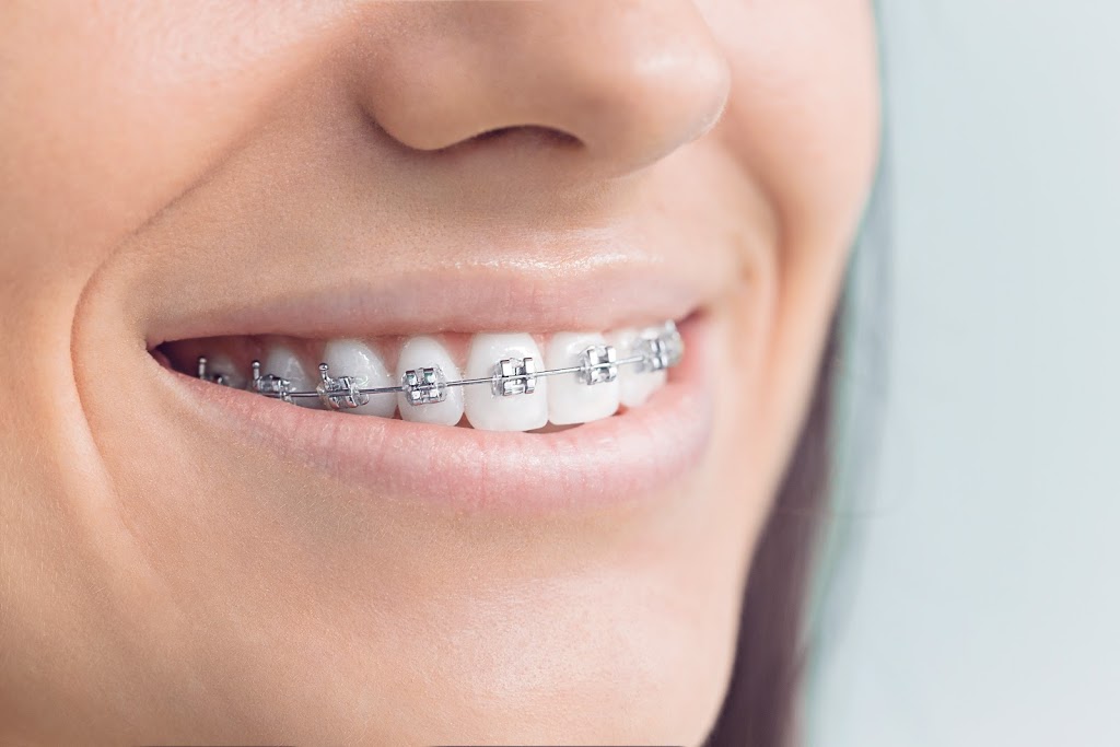Dr Sandhu S.M. Springdale dental centre | 2260 Bovaird Dr E Unit#119 & 120, Brampton, ON L6R 3J5, Canada | Phone: (905) 789-8266