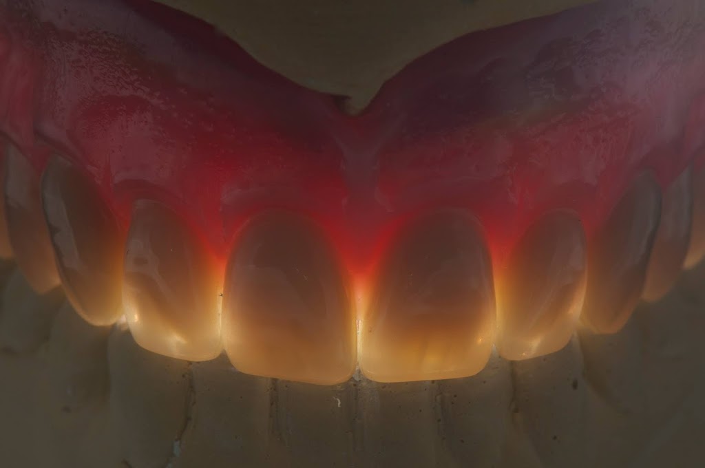 Hicks Dental Laboratory | 3302 Stone St, Port Huron, MI 48060, USA | Phone: (810) 984-4070