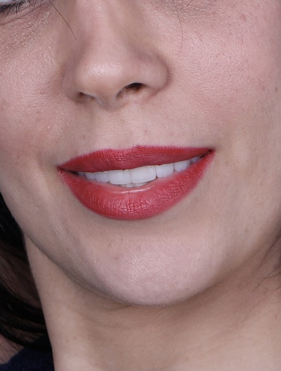 Newtonbrook Dental | 139 Finch Ave W, North York, ON M2N 2J1, Canada | Phone: (416) 223-2453