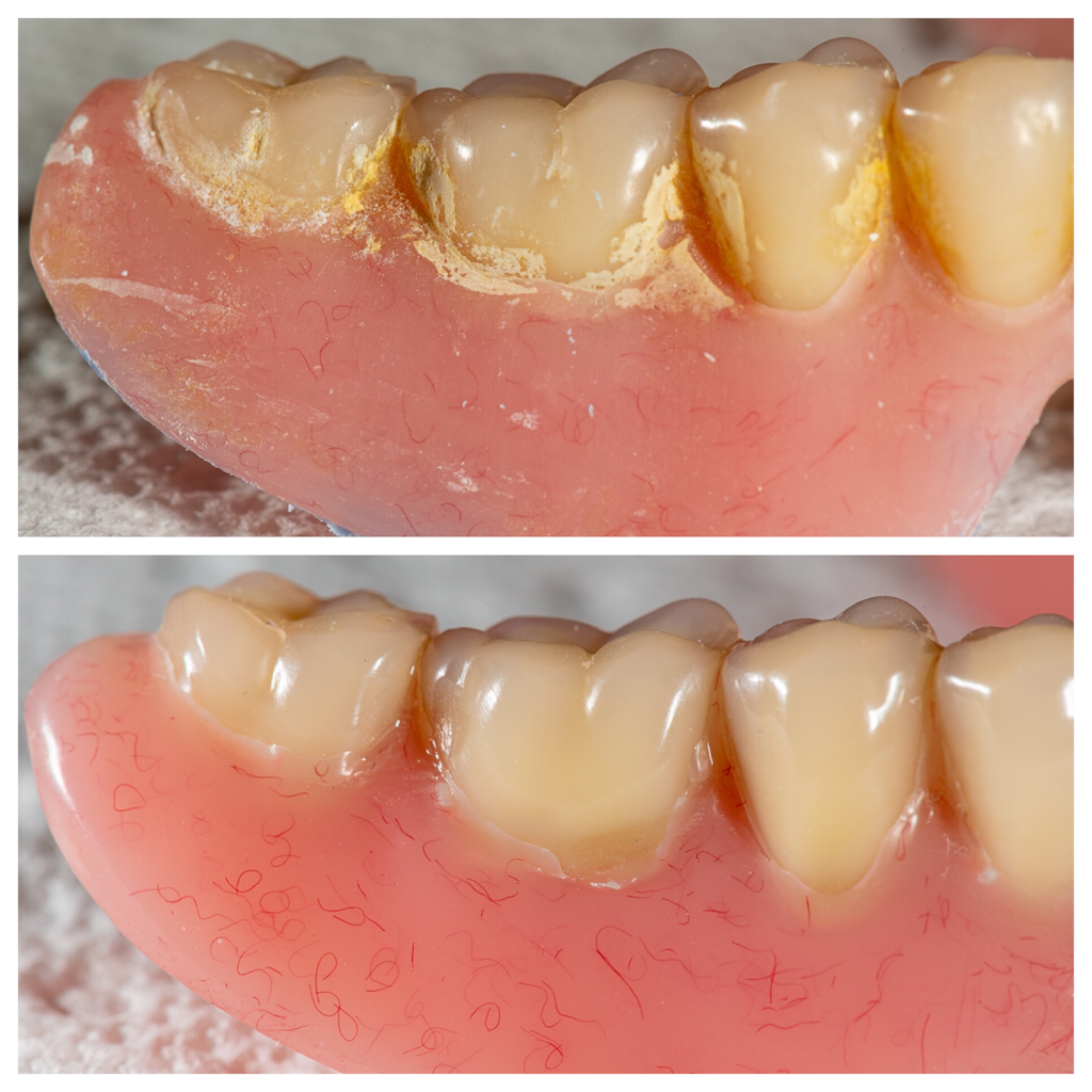 Caygeon Denture Clinic | 103 Main St, Bobcaygeon, ON K0M 1A0, Canada | Phone: (705) 738-5177