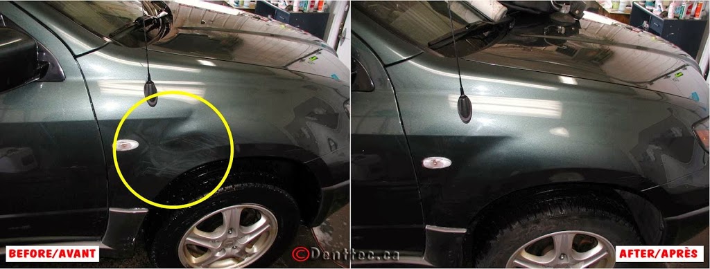 Dent Tec | 93 Rue Robert-Pilon, Gatineau, QC J9J 2X8, Canada | Phone: (819) 743-5252