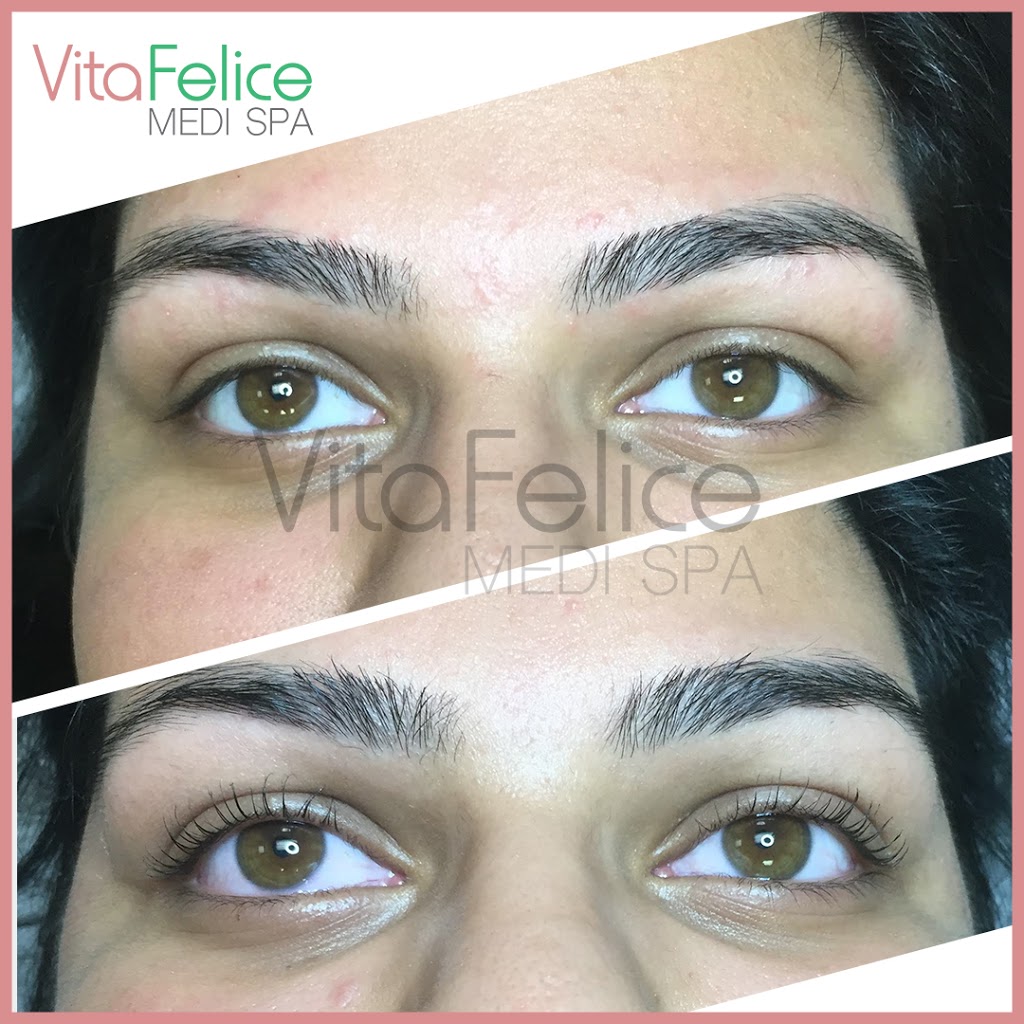 Vita Felice Medi Spa | 661 Columbia St, Unit 103, New Westminster, BC V3M 1A8, Canada | Phone: (778) 987-5480