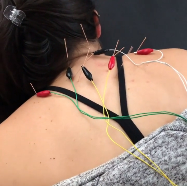Oshawa Chiropractic & Physiotherapy Wellness Centre | 549 King St E, Oshawa, ON L1H 1G3, Canada | Phone: (289) 274-7880