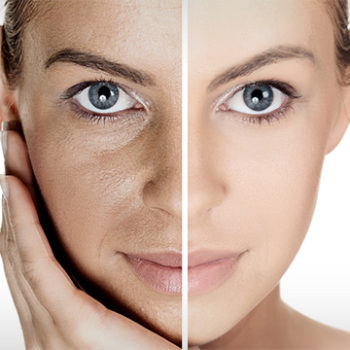 New You Spas (BodiSculpt) | 170 N Queen St K Unit 28, Etobicoke, ON M9C 1A8, Canada | Phone: (416) 221-9992