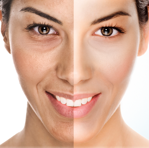 European Touch Beauty Centre | 5027 Hurontario St, Mississauga, ON L4Z 3X7, Canada | Phone: (905) 890-3773