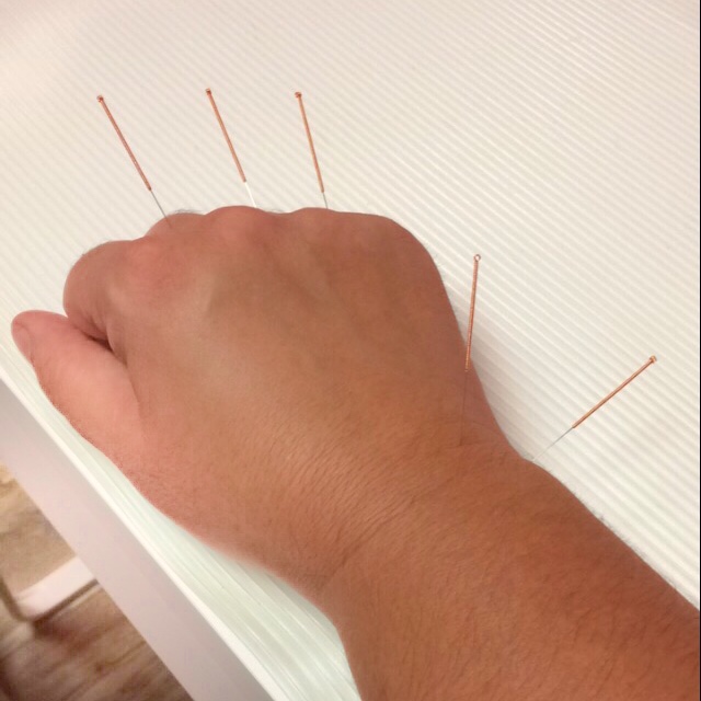 Marie-Hélène Falardeau Acupuncteure | 54 Bd Marie-Victorin, Delson, QC J5B 1A9, Canada | Phone: (450) 632-0000