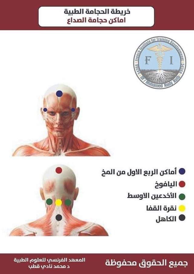 Hijama montreal clinic | 5805 Rue Lauzon, Montréal-Nord, QC H1G 2G9, Canada | Phone: (438) 221-5070