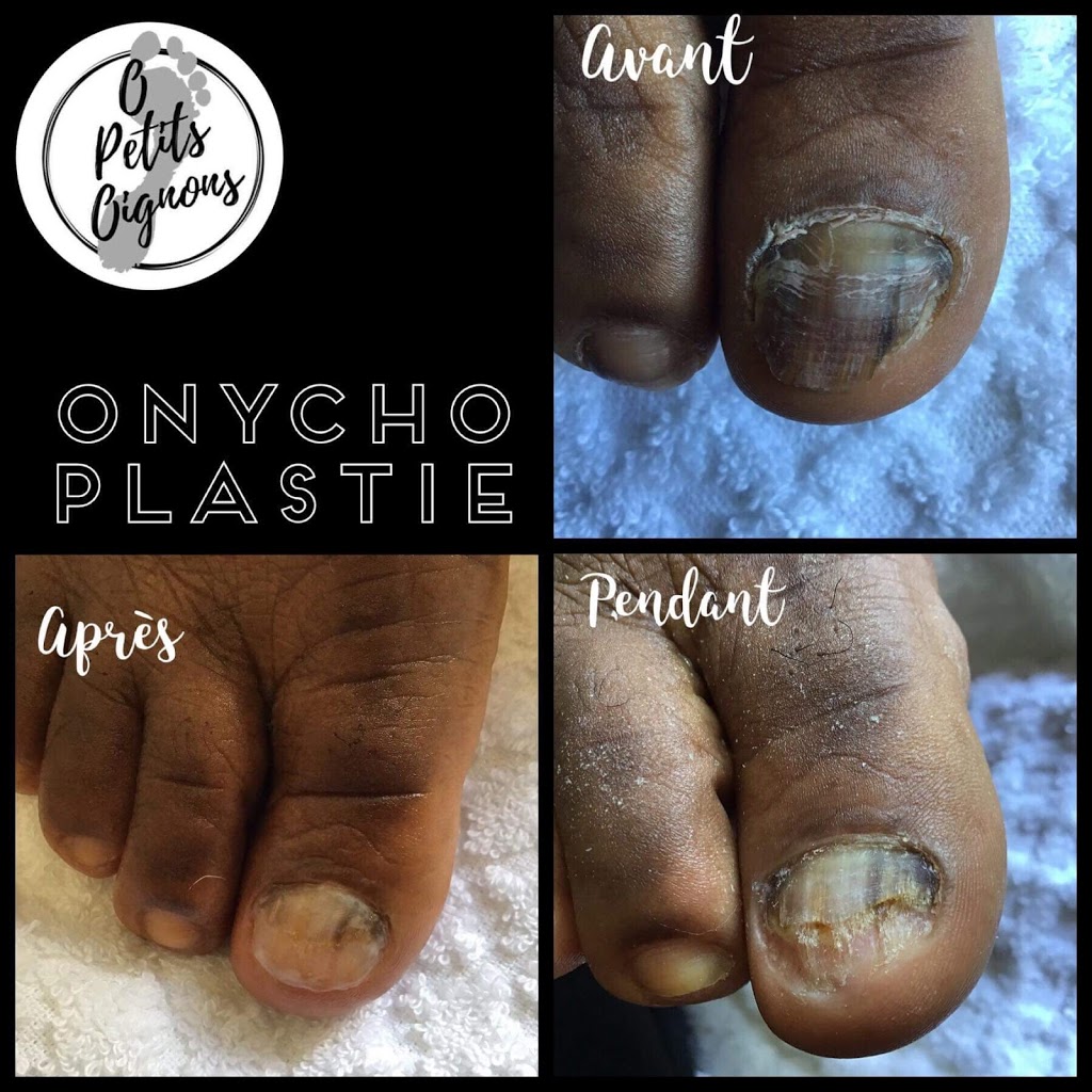 soins des pieds O petits oignons | 49 Rue du Hauban, Oka, QC J0N 1E0, Canada | Phone: (514) 627-8408