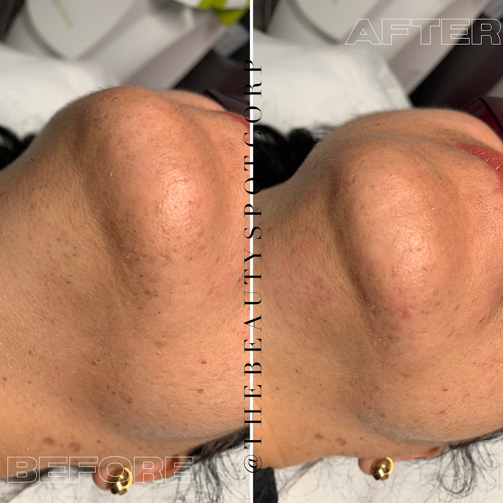 The Beauty Spot Corp. | 397 Kleinburg Smt Wy #1, Kleinburg, ON L4H 4T1, Canada | Phone: (647) 778-7356