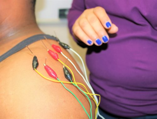 Body Works Physiotherapy Ellesmere Scarborough | 2100 Ellesmere Rd Unit 114, Scarborough, ON M1H 3B7, Canada | Phone: (416) 439-0533