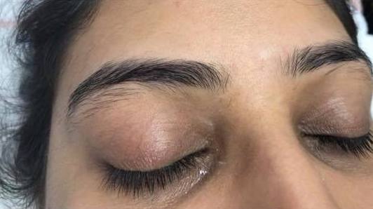 Glamorous Aesthetics & Laser Centre | 117-1100 Concordia Ave, Winnipeg, MB R2K 4B8, Canada | Phone: (204) 813-7012