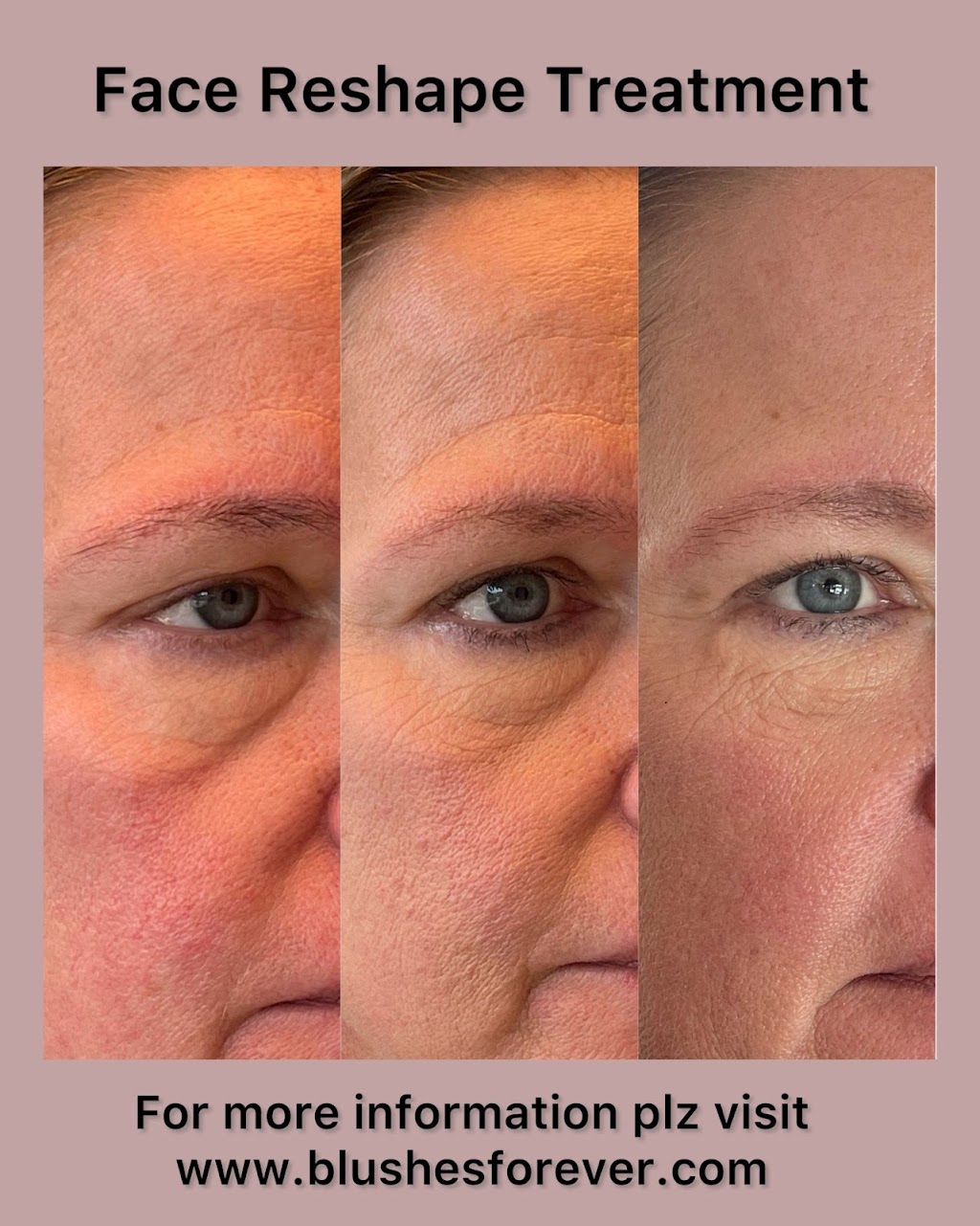 Blushes Forever Skin Care | H11C, 260300 Writing Creek Cres, Balzac, AB T4A 0X8, Canada | Phone: (825) 365-1610