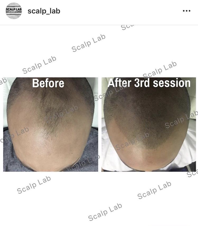 Scalp Lab | 135 Village Green Square, Scarborough, ON M1S 0G4, Canada | Phone: (416) 823-9300