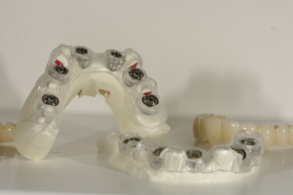 Advanced Implant Solutions | 6935 120 St #203, Delta, BC V4E 2A8, Canada | Phone: (604) 449-7626