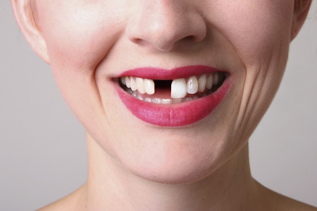 Dr. Ricky Leung | Dental Office | 2900 Steeles Ave E #201, Thornhill, ON L3T 4X1, Canada | Phone: (905) 881-3434