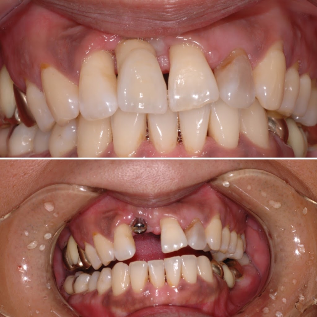 Chois Dental Studio | 1270 King St E, Cambridge, ON N3H 3P8, Canada | Phone: (289) 788-3996