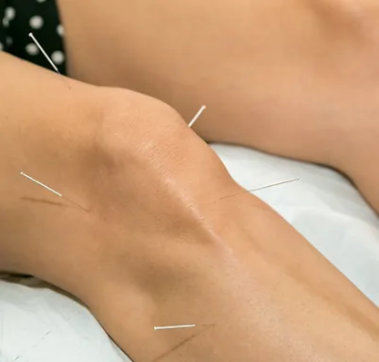 Hillside Physiotherapy | 117 Guelph St, Guelph, ON N0B 2K0, Canada | Phone: (519) 605-0510