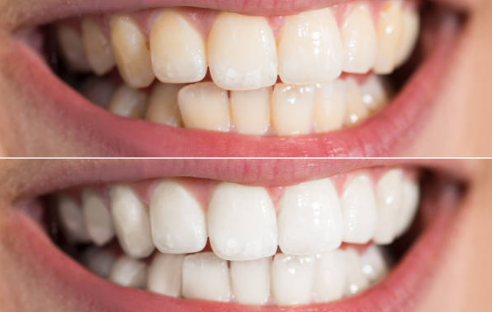 Lashing Effects | 23 Hearthstone Crescent, Courtice, ON L1E 2X7, Canada | Phone: (905) 926-4942