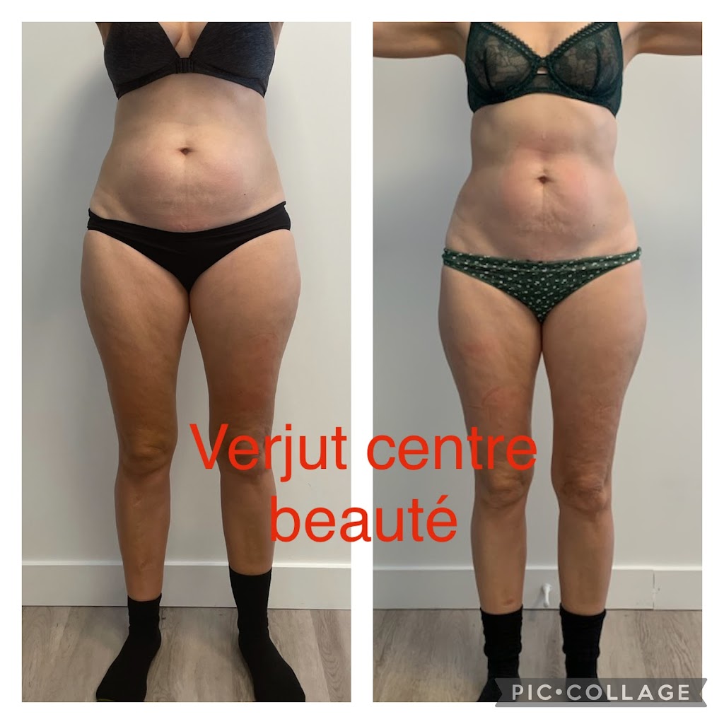 Verjut Centre de Beauté et dEsthétique à Laval | 1850 Boul. le Corbusier #308, Laval, QC H7S 2K1, Canada | Phone: (450) 973-9511