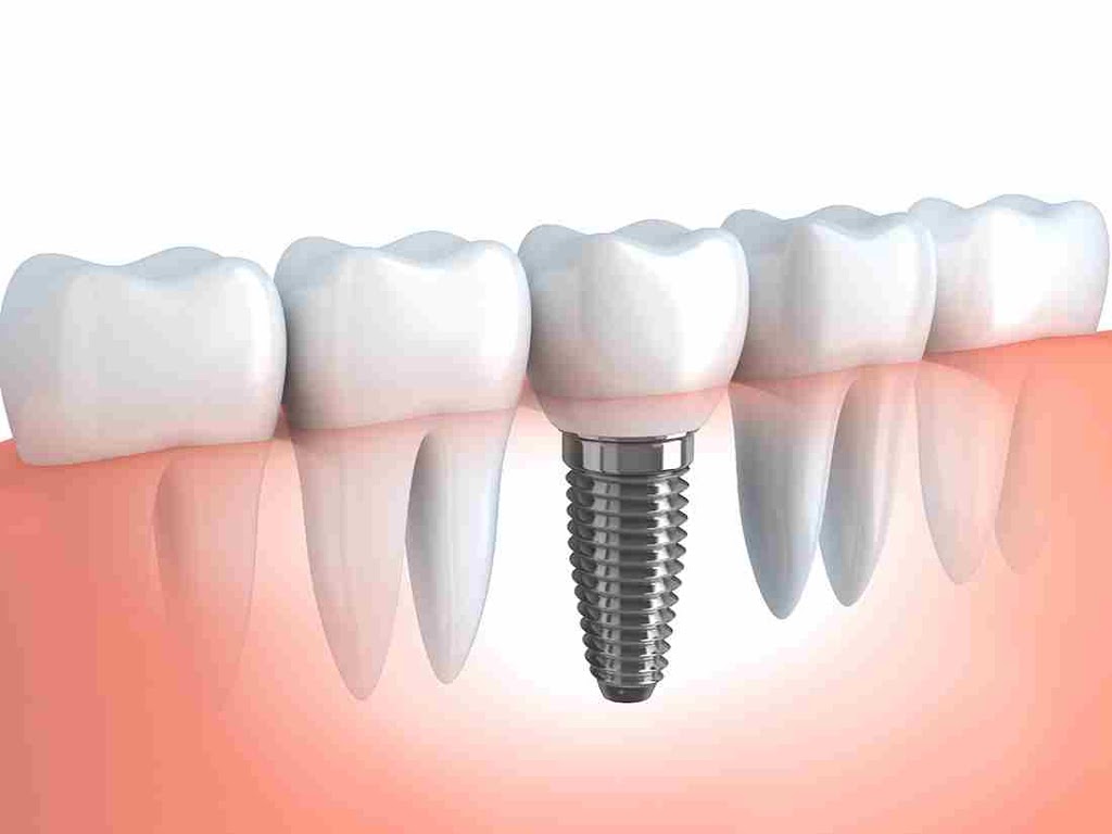 NorthPointe Dental Clinic | 388 Country Hills Blvd NE #510, Calgary, AB T3K 5J6, Canada | Phone: (403) 226-1155
