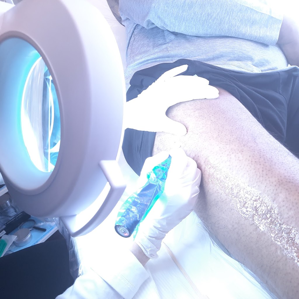 Efface Skin Care Clinic Inc. | 72 King St W, Stoney Creek, ON L8G 1H8, Canada | Phone: (905) 745-4097
