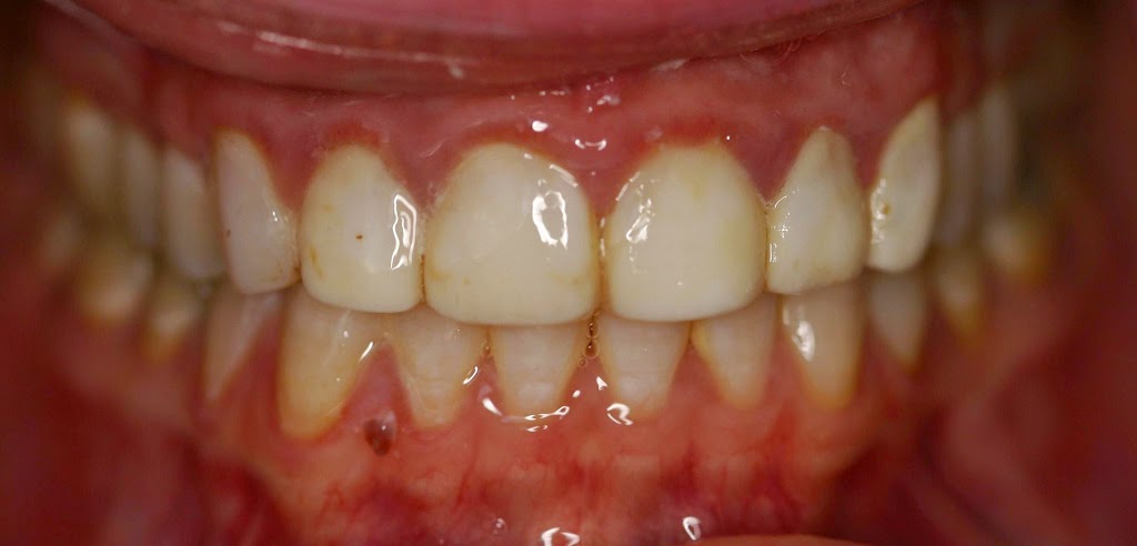 Cameron Dental | 105 - 117 Town Crest Rd, Fort Saskatchewan, AB T8L 0G7, Canada | Phone: (780) 589-4444