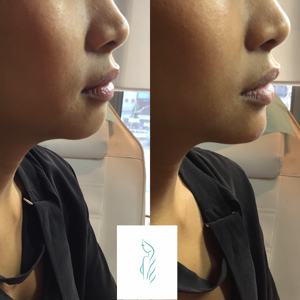 Let Them Notice - Botox Clinic Toronto/Etobicoke | 170 North Queen Street K, Unit 20, Toronto, ON M9C 1A8, Canada | Phone: (416) 904-6653