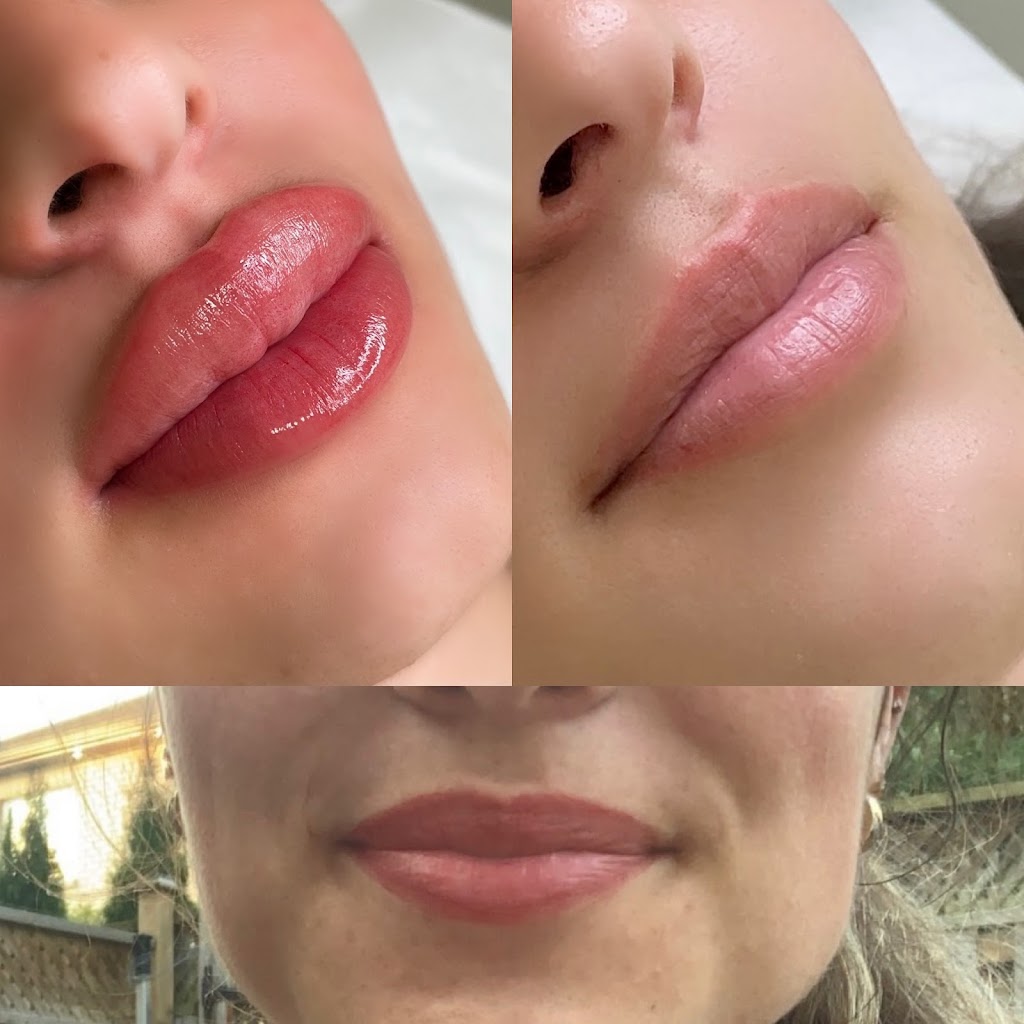 Natali Lischinski Medical Aesthetics & Cosmetic Tattoo | 8 Cooks Mill Crescent, Maple, ON L6A 0K8, Canada | Phone: (416) 700-3855