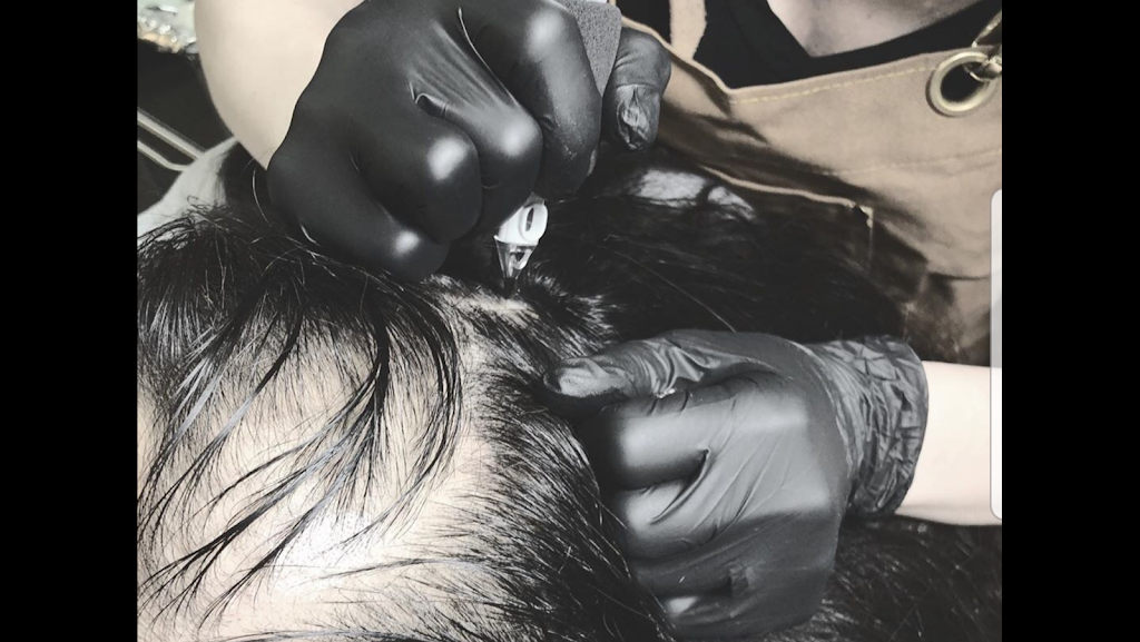 Winnipeg Scalp Micropigmentation | 3 Torrington Rd, Winnipeg, MB R3Y 1B4, Canada | Phone: (204) 999-0229
