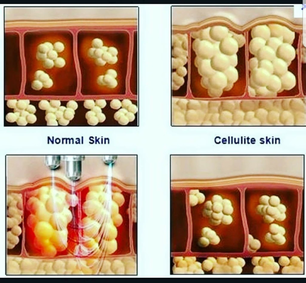 Rachels Skin & Body Care | 935 Booth Ave, Innisfil, ON L9S 0A5, Canada | Phone: (416) 559-2270