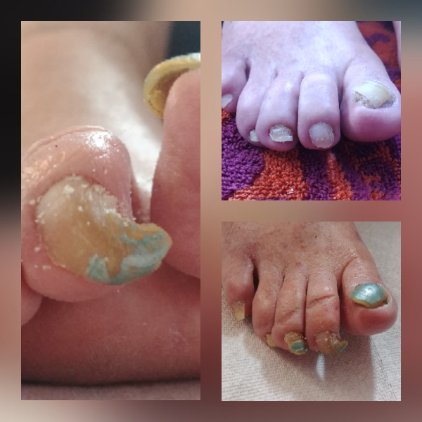 Jennifers Mobile Nursing Foot Care | Liberty St S, Bowmanville, ON L1C 2W1, Canada | Phone: (289) 892-5615