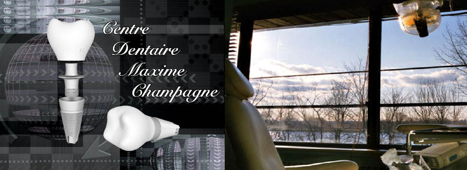 Centre dentaire Maxime Champagne | 1750 Boulevard Marie-Victorin, Longueuil, QC J4G 1A5, Canada | Phone: (450) 442-1000