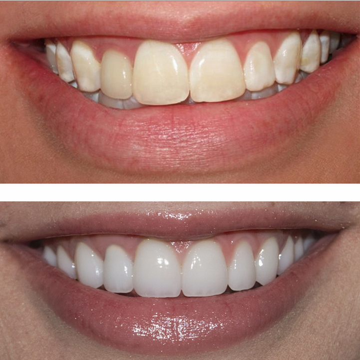Brickyard Dental Clinic | 201 - 6010 Brickyard Rd, Nanaimo, BC V9V 1S5, Canada | Phone: (250) 751-8782