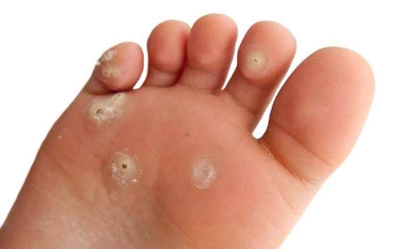 Tout en marchant Audrey Marchand infirmières en soins des pieds | 317 Rue Racine, Granby, QC J2G 3B6, Canada | Phone: (450) 405-3712