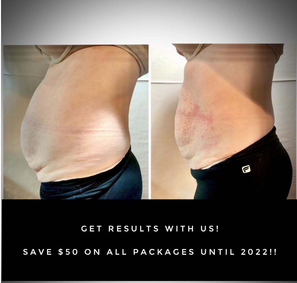 Flawless Beauty & Health Spa | 161 Colborne St W, Brantford, ON N3T 1L3, Canada | Phone: (226) 920-8244