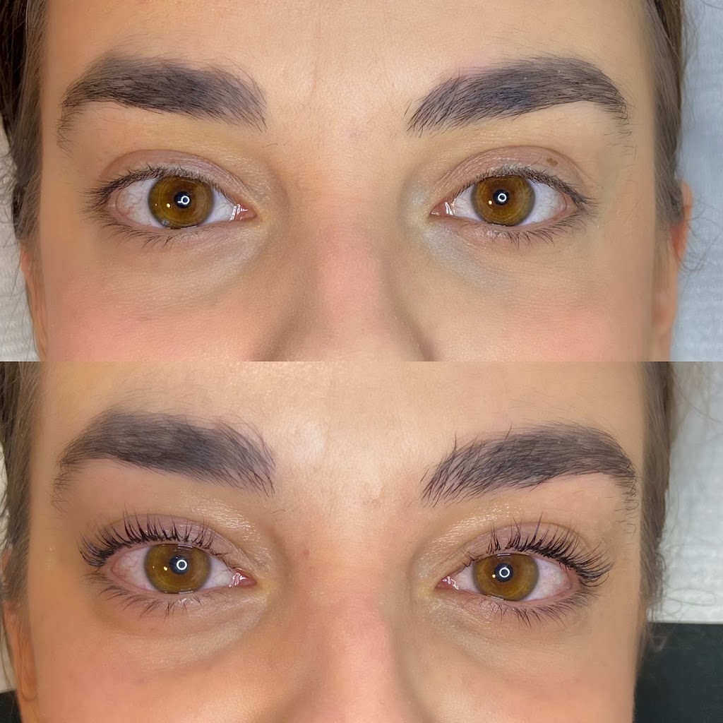 JJAesthetics | 164 Yellow Birch Dr, Kitchener, ON N2N 2N6, Canada | Phone: (519) 498-8601