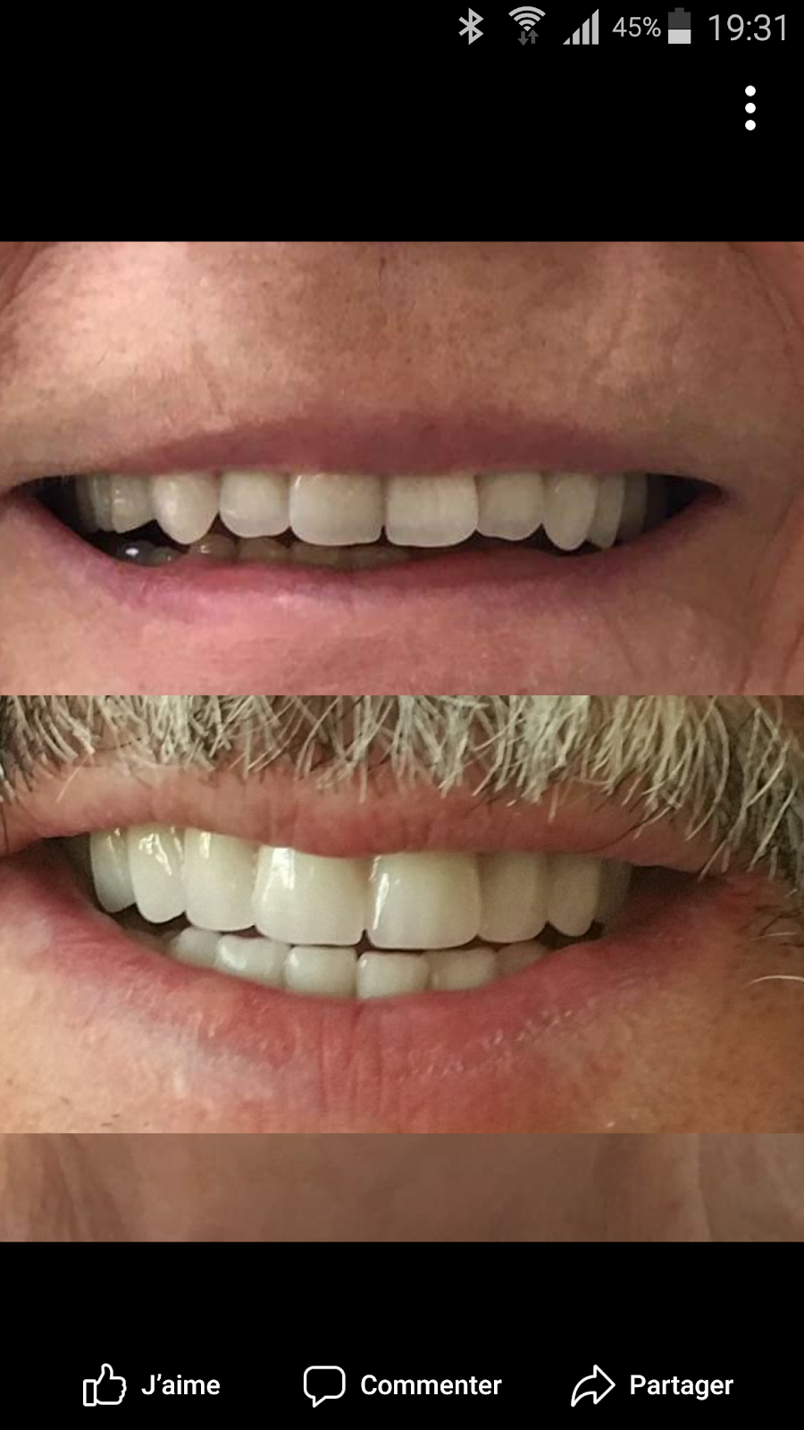 Denturologie Mon Sourire I Denturologiste Saint Laurent | 2505 Rue des Nations, Saint-Laurent, QC H4R 3C8, Canada | Phone: (514) 506-4983