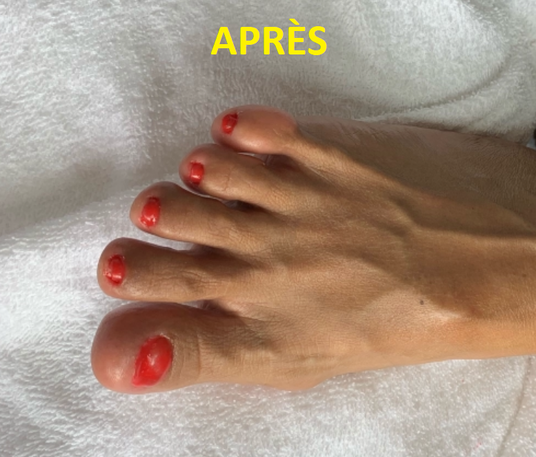 Vital-Pied - Soins podologiques (soins des pieds) | 16690 Rue des Quatre-Saisons, Mirabel, QC J7N 1J1, Canada | Phone: (819) 808-9259