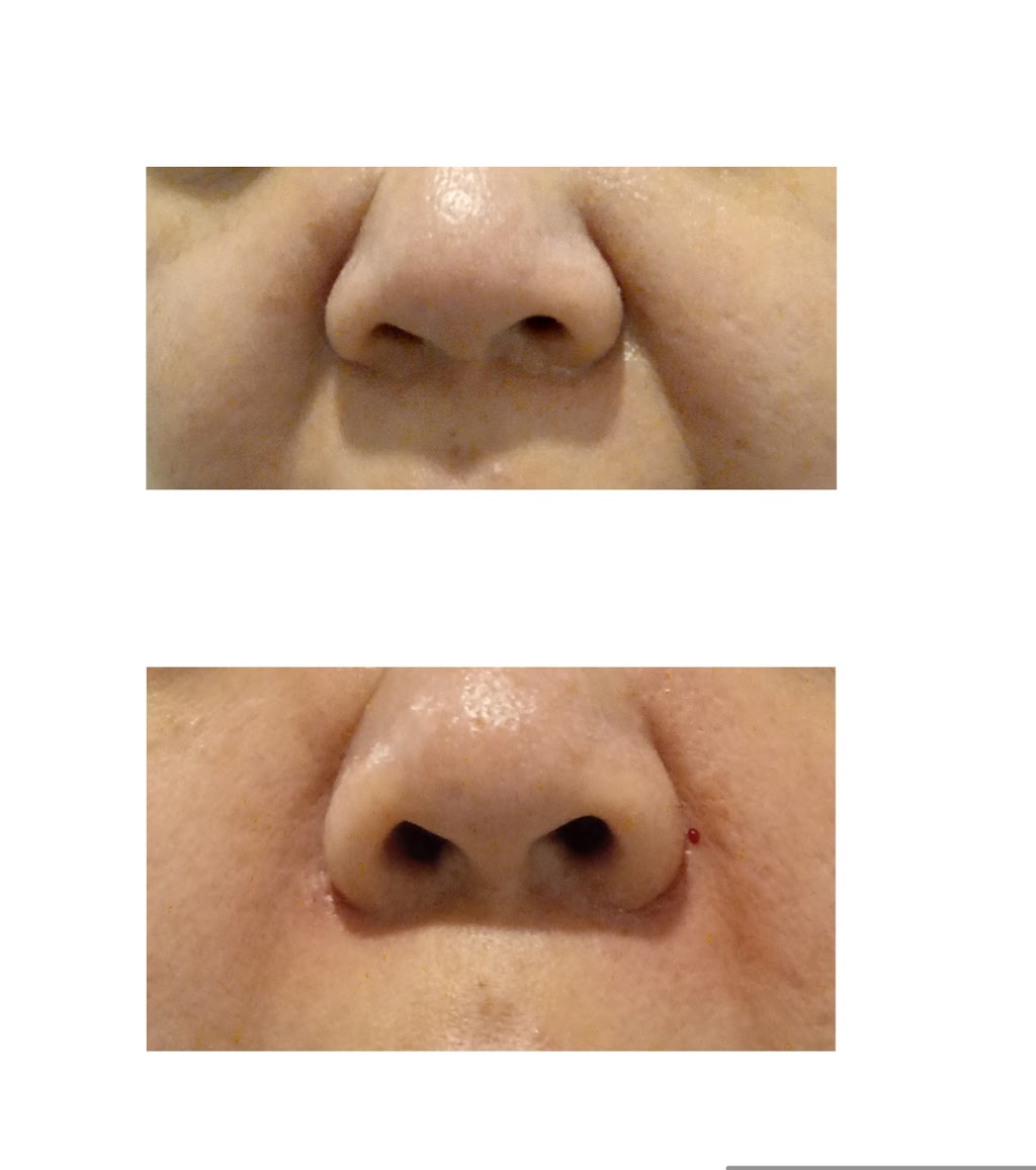 Tara Medical Esthetic | 31 Bingham St, Richmond Hill, ON L4C 8Y7, Canada | Phone: (647) 862-2154