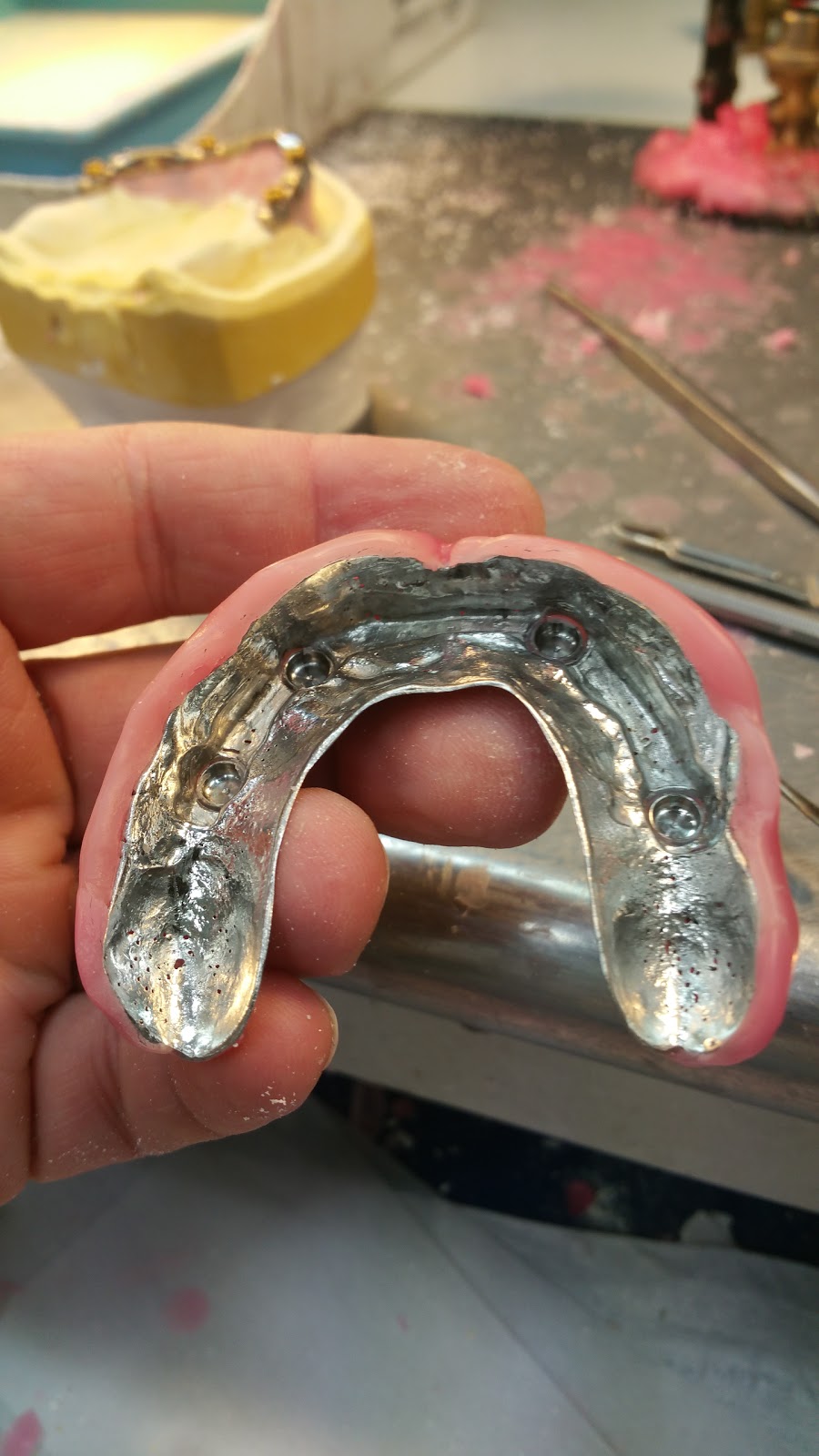 Esthetics Denture Studio Inc. | 3671 Westminster Hwy #240, Richmond, BC V7C 5W6, Canada | Phone: (604) 279-9151