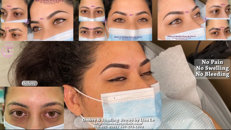 Lisa Beauty Clinic | 3220 Weston Rd, North York, ON M9M 2T7, Canada | Phone: (647) 273-1578