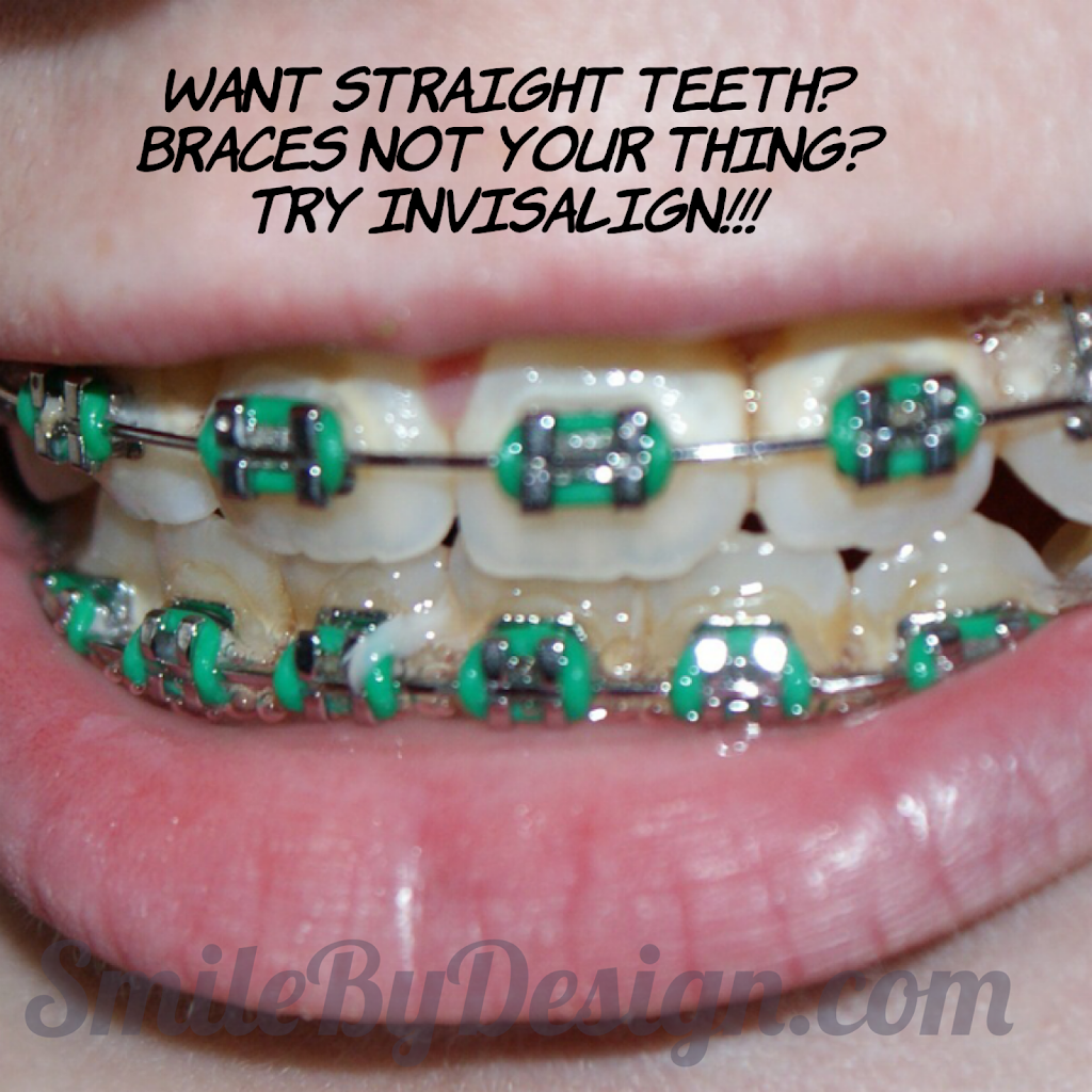 Limelight Dental | 4188 Living Arts Drive #2, Mississauga, ON L5B 0H7, Canada | Phone: (905) 949-2220