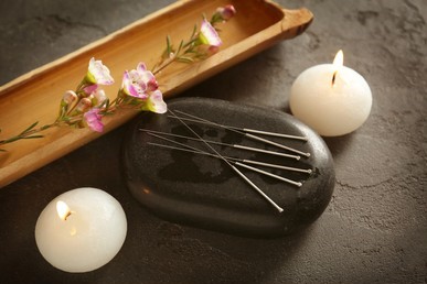 Roots and Branches Acupuncture | 2713c Dunsmuir Ave, Cumberland, BC V0R 1S0, Canada | Phone: (250) 650-3070