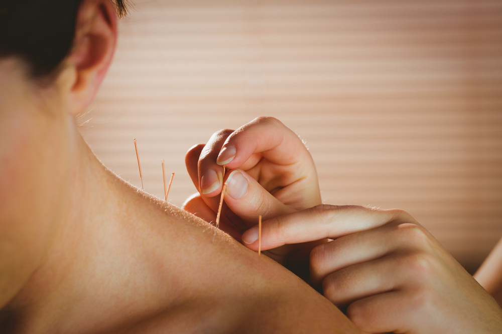 Registered Acupuncture and Massage Therapy | 1136 Aldersbrook Rd, London, ON N6G 2X8, Canada | Phone: (519) 601-5436